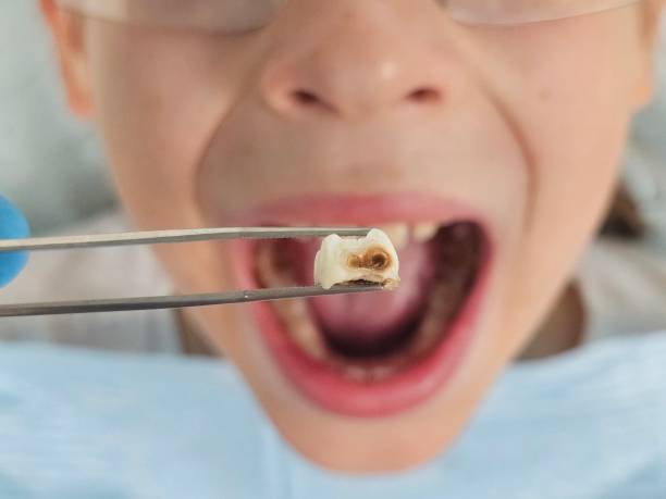 Best Same-Day Emergency Dental Services in Pleasant Valley, MO
