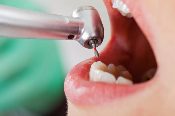 Best Emergency Dental Care for Broken or Chipped Teeth in Pleasant Valley, MO